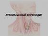 Аутоимунный тиреоидит