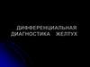 Дифференциальная диагностика желтух