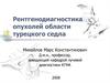Рентгенодиагностика опухолей области турецкого седла