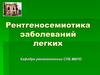 Рентгеносемиотика заболеваний легких