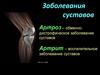 Заболевания суставов