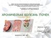 Хроническая болезнь почек