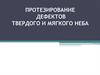 Протезирование дефектов твердого и мягкого неба
