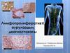 Лимфопролиферативті аурулардың диагностикасы