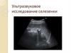 Ультразвуковое исследование селезенки