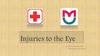 Injuries to the Eye