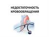 Недостаточность кровообращения. Классификация недостаточности кровообращения