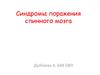 Синдромы поражения спинного мозга