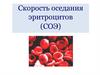 Скорость оседания эритроцитов (СОЭ)