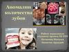 Аномалии количества зубов