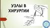 Узлы в хирургии