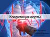 Коарктация аорты