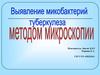 Выявление микобактерий туберкулеза методом микроскопии