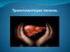 Трансплантация печени