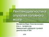 Рентгенодиагностика опухолей головного мозга