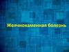 Желчекаменная болезнь