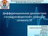 Дифференциальная диагностика псевдоинфарктной элевации сегмента ST
