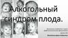 Алкогольный синдром плода
