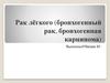 Рак лёгкого. Бронхогенный рак, бронхогенная карцинома