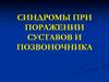 Синдромы при поражении суставов и позвоночника