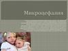 Микроцефалия. Признаки патологии