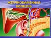 Желчнокаменная болезнь