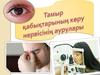 Тамыр қабықтарының көру нервісінің аурулары