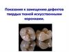 Показания к замещению дефектов твердых тканей искусственными коронками