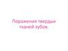 Поражения твердых тканей зубов