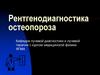 Рентгенодиагностика остеопороза