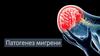 Патогенез мигрени