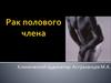 Рак полового члена