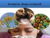 Аллергия. Виды аллергий