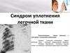 Синдром уплотнения легочной ткани