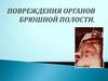 Повреждения органов брюшной полости
