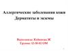 Аллергические заболевания кожи. Дерматиты и экземы