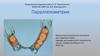 Параллелометрия. Планирование конструкции бюгельного протеза