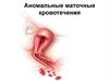 Аномальные маточные кровотечения