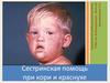 Сестринская помощь при кори и краснухе