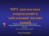 МРТ диагностика повреждений и заболеваний мягких тканей