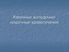 Язвенные желудочно-кишечные кровотечения