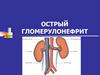 Острый гломерулонефрит