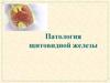 БЛХ. Болезни щитовидной железы