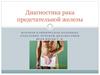Диагностика рака предстательной железы