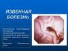 Язвенная болезнь