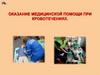 Оказание медицинской помощи при кровотечениях