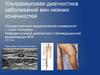 Ультразвуковая диагностика заболеваний вен нижних конечностей