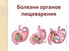 Болезни органов пищеварения
