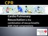 Cardio Pulmonary Resuscitation is the combination of rescue breaths with chest compressions