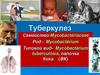 Туберкулез
